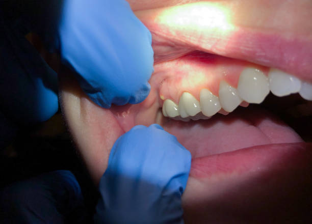 Best Emergency Dentist Near Me  in Henrietta, TX